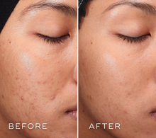 Load image into Gallery viewer, Press & Clear Exfoliating Toner